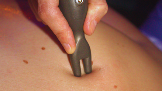 Fibrolisi: quando il corpo chiede di essere liberato